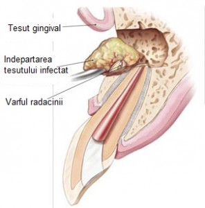 chirurgie